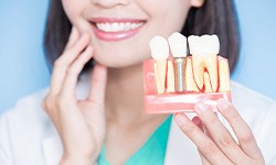 A dentist holding an enlarged dental implant model